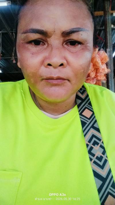 Naree 50 ปี Surin ไทย